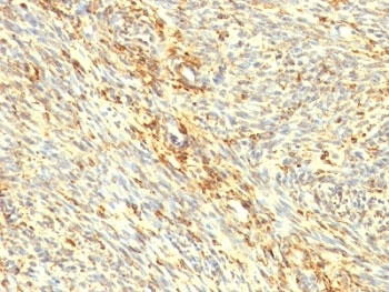 TGM2 / Transglutaminase 2 Antibody - Formalin-fixed, paraffin-embedded human uterus stained with Transglutaminase 2 antibody.  This image was taken for the unmodified form of this product. Other forms have not been tested.