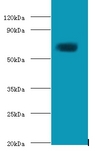 TGM2 / Transglutaminase 2 Antibody - Western blot of Protein-glutamine gamma-glutamyltransferase 2 antibody at 2 ug/ml with HepG2 whole cell lysate. Secondary: Goat polyclonal to Rabbit IgG at 1:10000 dilution. Predicted band size: 77.  This image was taken for the unconjugated form of this product. Other forms have not been tested.