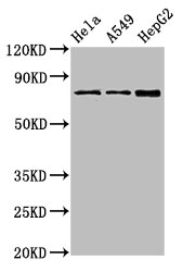 TGM2 / Transglutaminase 2 Antibody - Western Blot Positive WB detected in: Hela whole cell lysate, A549 whole cell lysate, HepG2 whole cell lysate All lanes: TGM2 antibody at 4µg/ml Secondary Goat polyclonal to rabbit IgG at 1/50000 dilution Predicted band size: 78, 62, 39 kDa Observed band size: 78 kDa