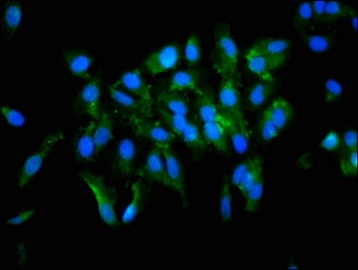 TGM2 / Transglutaminase 2 Antibody - Immunofluorescence staining of Hela cells with TGM2 Antibody at 1:133, counter-stained with DAPI. The cells were fixed in 4% formaldehyde, permeabilized using 0.2% Triton X-100 and blocked in 10% normal Goat Serum. The cells were then incubated with the antibody overnight at 4°C. The secondary antibody was Alexa Fluor 488-congugated AffiniPure Goat Anti-Rabbit IgG(H+L).