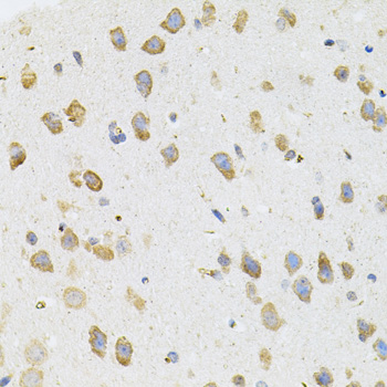 TGM2 / Transglutaminase 2 Antibody - Immunohistochemistry of paraffin-embedded mouse brain using TGM2 antibody(40x lens).