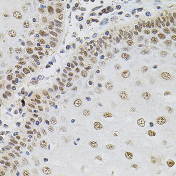 TGM2 / Transglutaminase 2 Antibody - Immunohistochemistry of paraffin-embedded human esophagus using TGM2 antibody(40x lens).