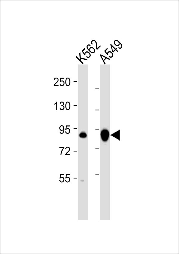 TGM2 / Transglutaminase 2 Antibody - All lanes : Anti-Transglutaminase 2 Antibody at 1:1000 dilution Lane 1: K562 whole cell lysates Lane 2: A549 whole cell lysates Lysates/proteins at 20 ug per lane. Secondary Goat Anti-Rabbit IgG, (H+L),Peroxidase conjugated at 1/10000 dilution Predicted band size : 77 kDa Blocking/Dilution buffer: 5% NFDM/TBST.