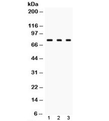 TGM2 / Transglutaminase 2 Antibody