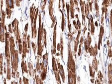 TGM2 / Transglutaminase 2 Antibody - 1:100 staining human heart muscle tissue by IHC-P. The tissue was formaldehyde fixed and a heat mediated antigen retrieval step in citrate buffer was performed. The tissue was then blocked and incubated with the antibody for 1.5 hours at 22°C. An HRP conjugated goat anti-rabbit antibody was used as the secondary.