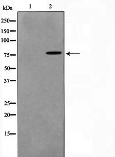 TGM2 / Transglutaminase 2 Antibody - Western blot analysis on HuvEc cell lysates using TGM2 antibody. The lane on the left is treated with the antigen-specific peptide.