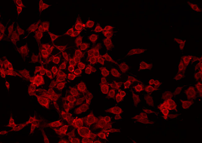 TGM2 / Transglutaminase 2 Antibody - Staining HuvEc cells by IF/ICC. The samples were fixed with PFA and permeabilized in 0.1% Triton X-100, then blocked in 10% serum for 45 min at 25°C. The primary antibody was diluted at 1:200 and incubated with the sample for 1 hour at 37°C. An Alexa Fluor 594 conjugated goat anti-rabbit IgG (H+L) Ab, diluted at 1/600, was used as the secondary antibody.