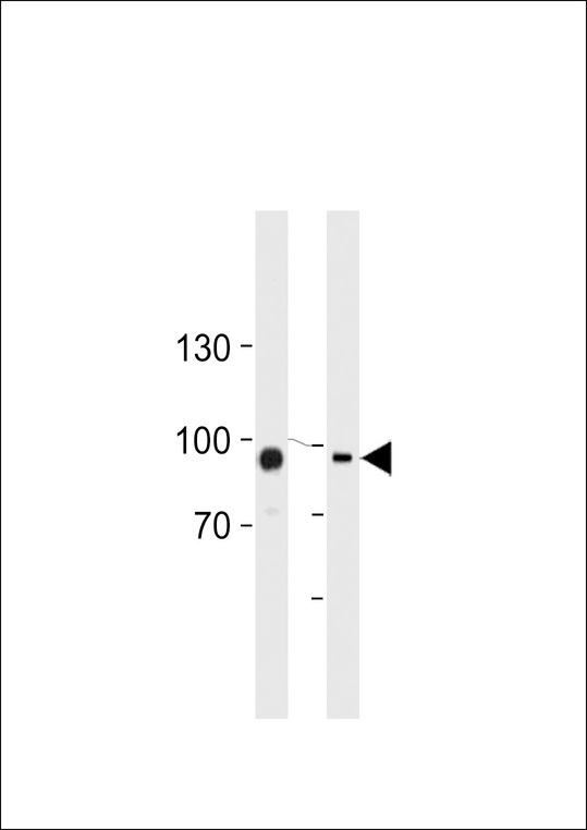 TGM2 / Transglutaminase 2 Antibody - TGM2 Antibody (Center K444) western blot of HUVEC,K562 cell line lysates (35 ug/lane). The TGM2 antibody detected the TGM2 protein (arrow).