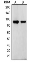 TGM2 / Transglutaminase 2 Antibody - Western blot analysis of Transglutaminase 2 expression in ECV304 (A); TF1 (B) whole cell lysates.