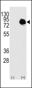 TGM2 / Transglutaminase 2 Antibody - Western blot of TGM2 (arrow) using rabbit polyclonal TGM2 Antibody (Center T428). 293 cell lysates (2 ug/lane) either nontransfected (c) or transiently transfected with the TGM2 gene (Lane 2) (Origene Technologies).
