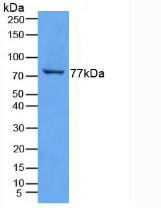 TGM3 / Transglutaminase 3 Antibody