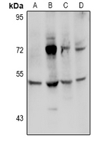 TGM3 / Transglutaminase 3 Antibody - Western blot analysis of Transglutaminase 3 expression in LO2 (A), HEK293T (B), CT26 (C), H9C2 (D) whole cell lysates.