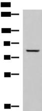 TGM3 / Transglutaminase 3 Antibody - Western blot analysis of Human tongue tissue lysate  using TGM3 Polyclonal Antibody at dilution of 1:800