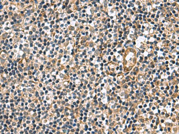 TGM3 / Transglutaminase 3 Antibody - Immunohistochemistry of paraffin-embedded Human tonsil tissue  using TGM3 Polyclonal Antibody at dilution of 1:110(×200)