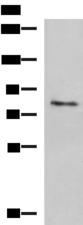 TGM3 / Transglutaminase 3 Antibody - Western blot analysis of Human skin tissue lysate  using TGM3 Polyclonal Antibody at dilution of 1:1600
