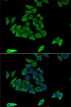 TGM3 / Transglutaminase 3 Antibody - Immunofluorescence analysis of U2OS cells using TGM3 Polyclonal Antibody.