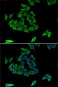 TGM3 / Transglutaminase 3 Antibody - Immunofluorescence analysis of U2OS cells using TGM3 Polyclonal Antibody.