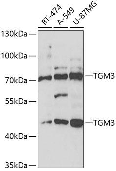 TGM3 / Transglutaminase 3 Antibody - Western blot analysis of extracts of various cell lines using TGM3 Polyclonal Antibody at dilution of 1:1000.