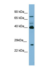 TGM3 / Transglutaminase 3 Antibody - TGM3 / Transglutaminase 3 antibody Western blot of PANC1 cell lysate. This image was taken for the unconjugated form of this product. Other forms have not been tested.