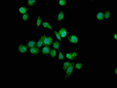 TGM4 / Transglutaminase 4 Antibody - Immunofluorescence staining of SH-SY5Y cells with TGM4 Antibody at 1:100, counter-stained with DAPI. The cells were fixed in 4% formaldehyde, permeabilized using 0.2% Triton X-100 and blocked in 10% normal Goat Serum. The cells were then incubated with the antibody overnight at 4°C. The secondary antibody was Alexa Fluor 488-congugated AffiniPure Goat Anti-Rabbit IgG(H+L).