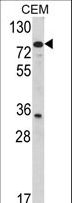 TGM4 / Transglutaminase 4 Antibody - Western blot of TGM4 Antibody in CEM cell line lysates (35 ug/lane). TGM4 (arrow) was detected using the purified antibody.