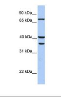 TGM5 / Transglutaminase 5 Antibody - Hela cell lysate. Antibody concentration: 1.0 ug/ml. Gel concentration: 12%.  This image was taken for the unconjugated form of this product. Other forms have not been tested.