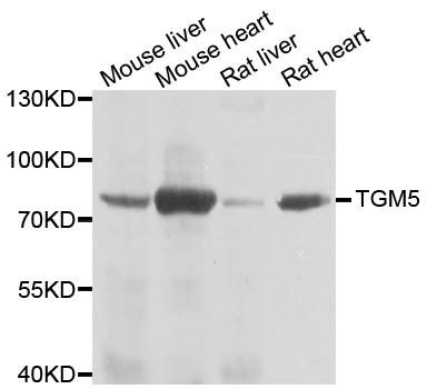 TGM5 / Transglutaminase 5 Antibody - Western blot analysis of extracts of various cell lines.