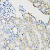 TGM5 / Transglutaminase 5 Antibody - Immunohistochemistry of paraffin-embedded rat kidney tissue.