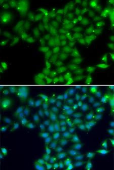 TGM5 / Transglutaminase 5 Antibody - Immunofluorescence analysis of U20S cells.