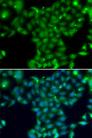 TGM5 / Transglutaminase 5 Antibody - Immunofluorescence analysis of U2OS cells using TGM5 Polyclonal Antibody.