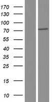 TGM5 / Transglutaminase 5 Protein - Western validation with an anti-DDK antibody * L: Control HEK293 lysate R: Over-expression lysate