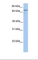 TGM7 / Transglutaminase 7 Antibody - 721_B cell lysate. Antibody concentration: 1.0 ug/ml. Gel concentration: 12%.  This image was taken for the unconjugated form of this product. Other forms have not been tested.