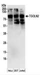 TGN46 / TGN38 Antibody - Detection of Human TGOLN2 by Western Blot. Samples: Whole cell lysate (50 ug) prepared using NETN buffer from HeLa, 293T, and Jurkat cells. Antibodies: Affinity purified rabbit anti-TGOLN2 antibody used for WB at 0.1 ug/ml. Detection: Chemiluminescence with an exposure time of 30 seconds.