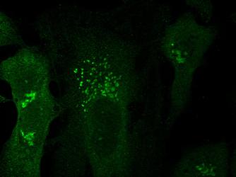 TGN46 / TGN38 Antibody - TGN46 Antibody - Golgi Apparatus marker - TGOLN2 antibody was tested at 1:100 in HeLa cells with FITC (green).  This image was taken for the unconjugated form of this product. Other forms have not been tested.
