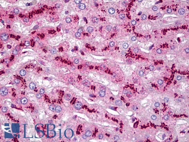 TGN46 / TGN38 Antibody - Anti-TGOLN2 / TGN46 antibody IHC of human liver. Immunohistochemistry of formalin-fixed, paraffin-embedded tissue after heat-induced antigen retrieval. Antibody concentration 5 ug/ml.  This image was taken for the unconjugated form of this product. Other forms have not been tested.