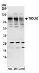 TGN46 / TGN38 Antibody - Detection of Human TGOLN2 by Western Blot. Samples: Whole cell lysate (50 ug) prepared using NETN buffer from HeLa, 293T, and Jurkat cells. Antibodies: Affinity purified rabbit anti-TGOLN2 antibody used for WB at 0.4 ug/ml. Detection: Chemiluminescence with an exposure time of 30 seconds.