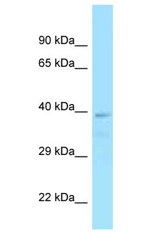 TGN46 / TGN38 Antibody - TGN46 / TGN38 antibody Western Blot of OVCAR-3. Antibody dilution: 1 ug/ml.  This image was taken for the unconjugated form of this product. Other forms have not been tested.