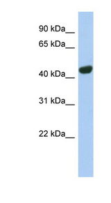TGN46 / TGN38 Antibody - TGOLN2 / TGN46 antibody Western blot of Fetal Stomach lysate. This image was taken for the unconjugated form of this product. Other forms have not been tested.