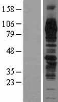 TGN46 / TGN38 Protein - Western validation with an anti-DDK antibody * L: Control HEK293 lysate R: Over-expression lysate