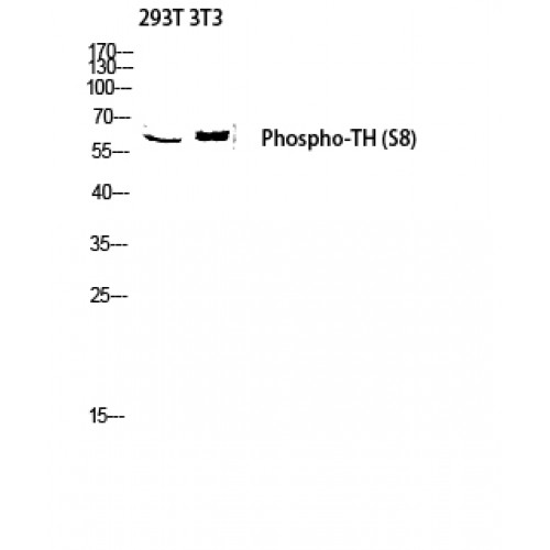 TH / Tyrosine Hydroxylase Antibody - Western blot of Phospho-TH (S8) antibody