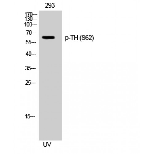 TH / Tyrosine Hydroxylase Antibody - Western blot of Phospho-TH (S62) antibody