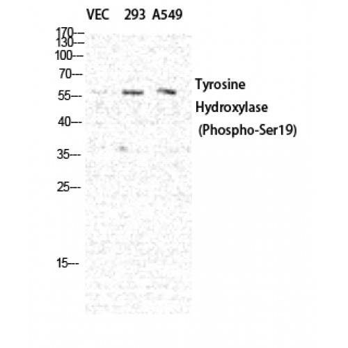 TH / Tyrosine Hydroxylase Antibody - Western blot of Phospho-TH (S19) antibody