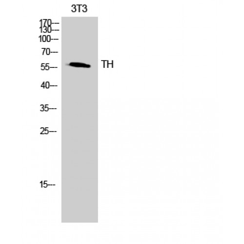 TH / Tyrosine Hydroxylase Antibody - Western blot of TH antibody