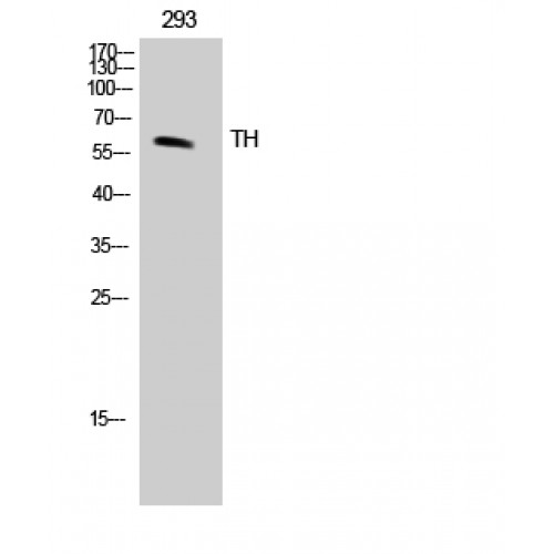 TH / Tyrosine Hydroxylase Antibody - Western blot of TH antibody