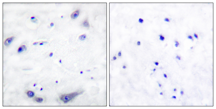 TH / Tyrosine Hydroxylase Antibody - Immunohistochemistry analysis of paraffin-embedded human brain tissue, using Tyrosine Hydroxylase Antibody. The picture on the right is blocked with the synthesized peptide.
