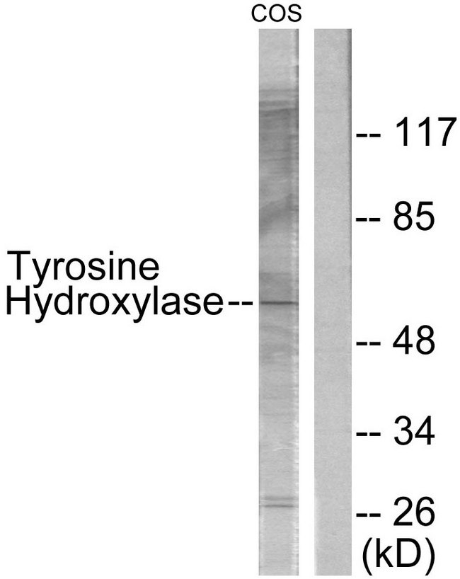 TH / Tyrosine Hydroxylase Antibody - Western blot analysis of lysates from COS7, using Tyrosine Hydroxylase Antibody. The lane on the right is blocked with the synthesized peptide.