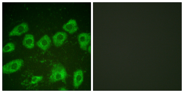 TH / Tyrosine Hydroxylase Antibody - Immunofluorescence analysis of HUVEC cells, using Tyrosine Hydroxylase Antibody. The picture on the right is blocked with the synthesized peptide.