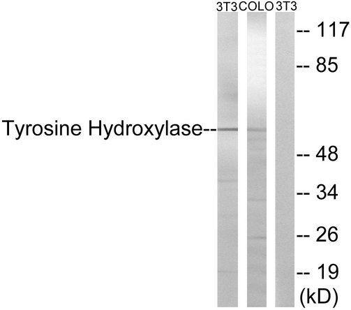 TH / Tyrosine Hydroxylase Antibody - Western blot analysis of lysates from NIH/3T3/COLO cells, treated with Forskolin 40nM 30', using Tyrosine Hydroxylase Antibody. The lane on the right is blocked with the synthesized peptide.