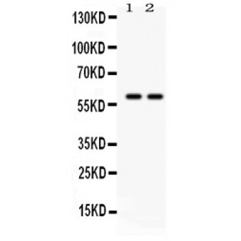 TH / Tyrosine Hydroxylase Antibody - TH antibody Western blot. All lanes: Anti TH at 0.5 ug/ml. Lane 1: Rat Brain Tissue Lysate at 50 ug. Lane 2: Mouse Brain Tissue Lysate at 50 ug. Predicted band size: 59 kD. Observed band size: 59 kD.