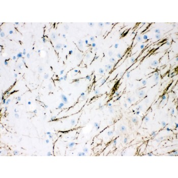 TH / Tyrosine Hydroxylase Antibody - TH antibody IHC-paraffin. IHC(P): Mouse Brain Tissue.